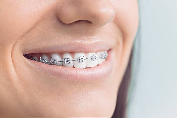 Best Traditional Braces  in Malverne, NY